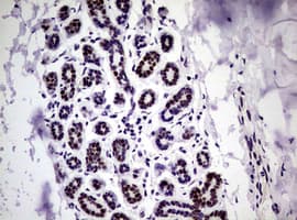 NBN / Nibrin Antibody (clone OTI6H7)