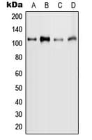 Polyclonal Rabbit anti-Human MYBL2 Antibody (phospho-Ser577, WB)