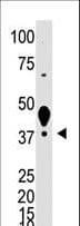 IHC-plus™ Polyclonal Rabbit anti-Human LYVE1 Antibody (aa46-77, IHC, WB)