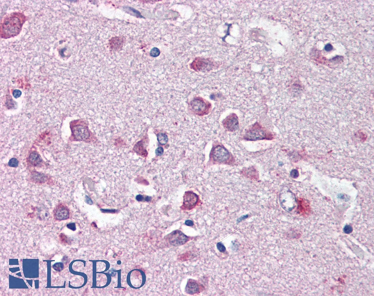 IHC-plus™ NF2 / Merlin Antibody (aa526-536)
