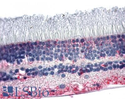 IHC-plus™ Polyclonal Rabbit anti-Human NR2E3 / PNR Antibody (N-Terminus, IHC)