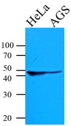 IHC-plus™ KRT18 / CK18 / Cytokeratin 18 Antibody (clone AT2G3)
