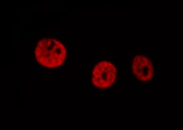 DDIT3 / CHOP Antibody