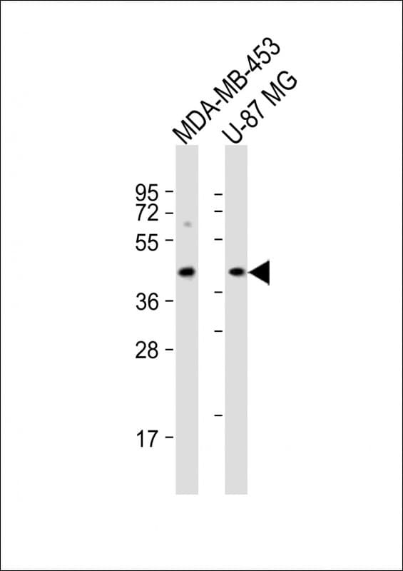 Polyclonal Rabbit anti-Human PABPC5 Antibody (aa287-321, WB)
