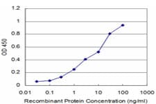 Monoclonal Mouse anti-Human PTX3 / Pentraxin 3 Antibody (clone 5B7, WB)