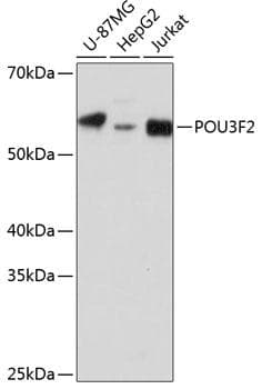 Polyclonal Rabbit anti-Human BRN2 / POU3F2 Antibody (WB)