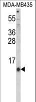 HAMP / Hepcidin Antibody (aa17-46)