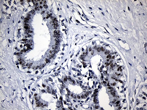 SUPT16H / FACTP140 Antibody (aa187-282, clone OTI8A1)