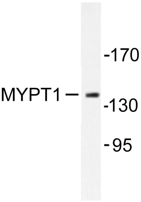 PPP1R12A / MYPT1 Antibody (Arg690)