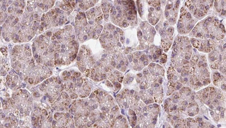 FBXO22 Antibody