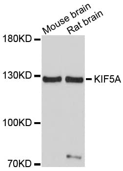 Polyclonal Rabbit anti-Human Kinesin 5A / KIF5A Antibody (WB)