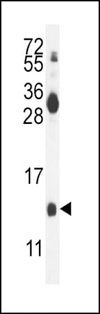MDK / Midkine Antibody (aa113-143)