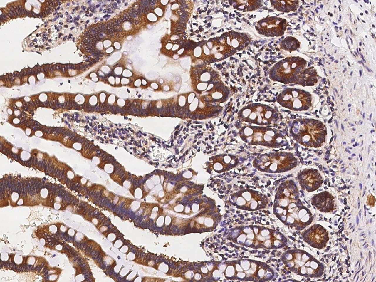 ARA70 / NCOA4 Antibody