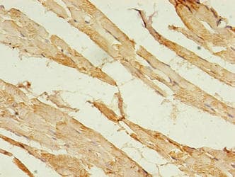 ACS5 / ACSL5 Antibody