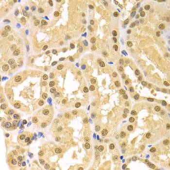 SFN / Stratifin / 14-3-3 Sigma Antibody