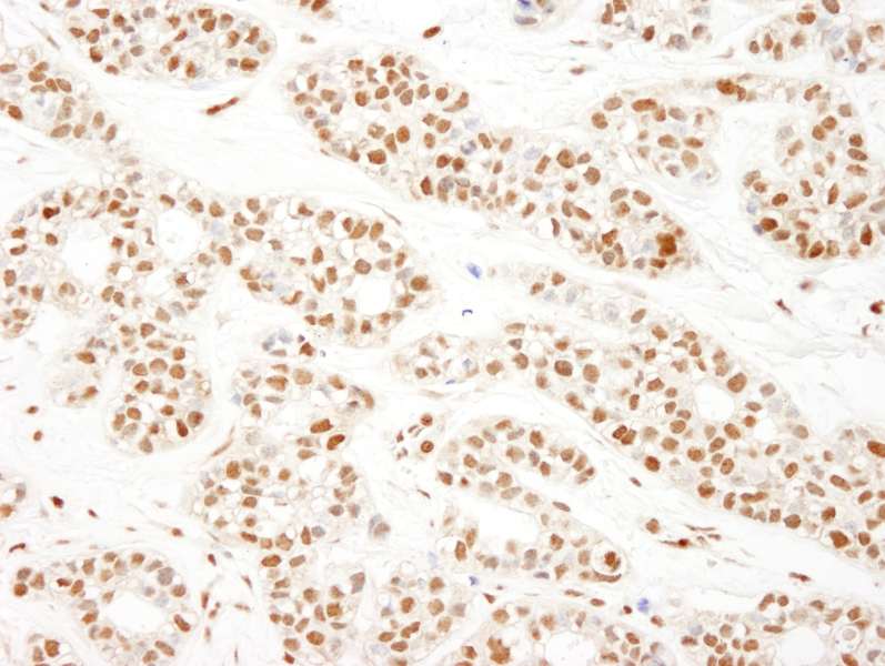 KHSRP / FBP2 Antibody (aa660-710)