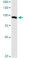 Monoclonal Mouse anti-Human MARK2 Antibody (clone 3B12, WB)