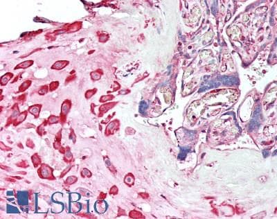 STK38 Antibody