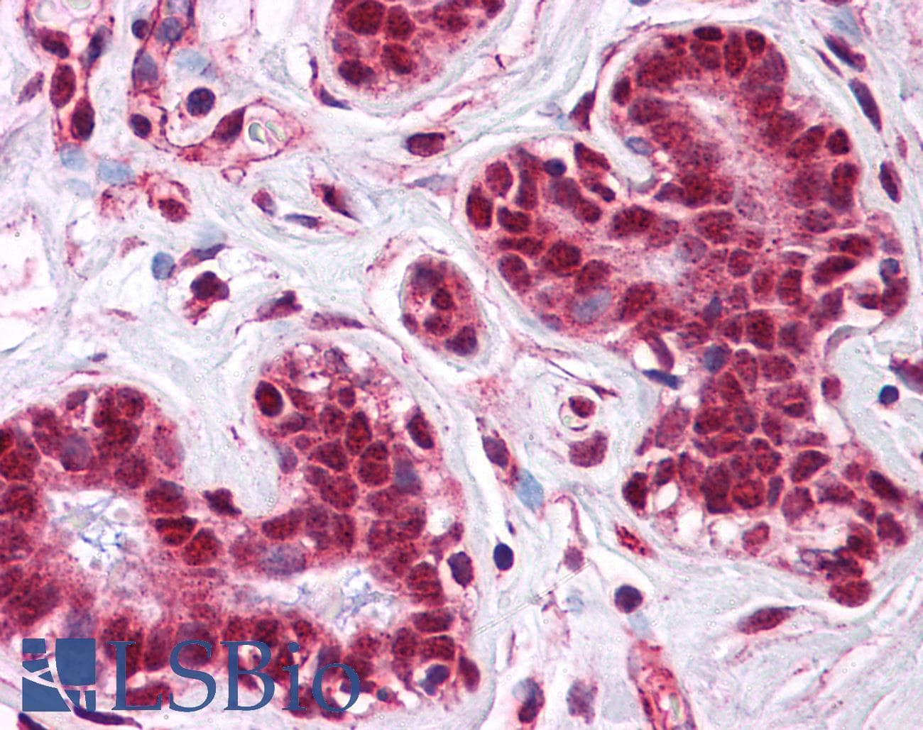 IHC-plus™ LMBRD1 Antibody