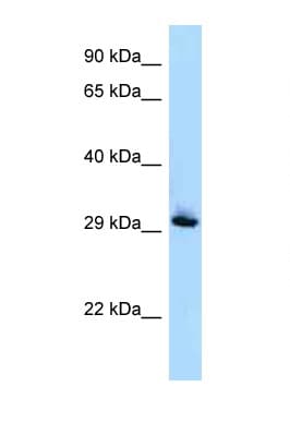 RAB33B Antibody (aa80-129)