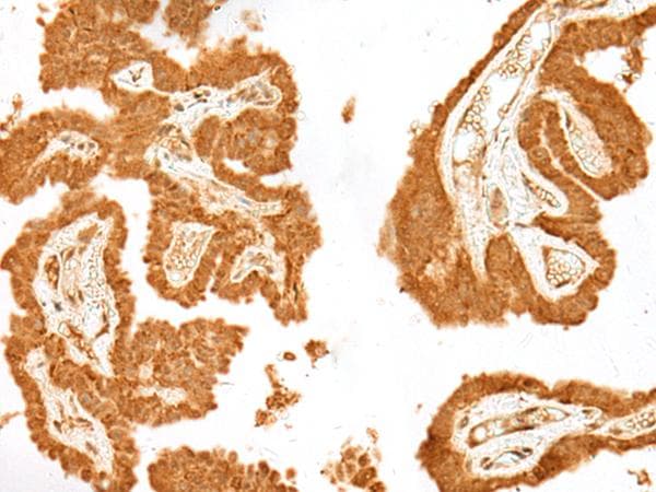 GANC Antibody