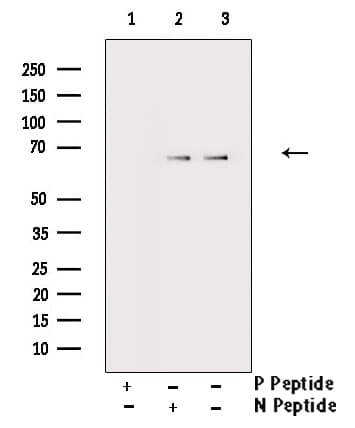 FRS2 Antibody (phospho-Tyr436)