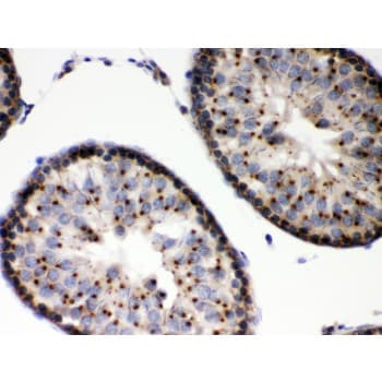 EBAG9 / RCAS1 Antibody (aa31-213)