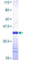 Human SLMAP / SLAP Protein (Recombinant GST, N-terminus)