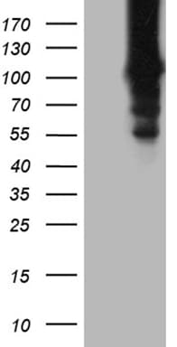 Monoclonal Mouse anti-Human HACE1 Antibody (clone OTI6H8, WB)
