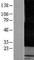 RAB3A Protein (Over-Expression Lysate Myc-DDK (Flag))
