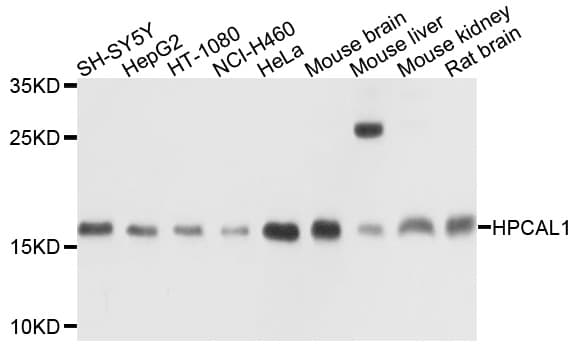 Polyclonal Rabbit anti-Human HPCAL1 / Hippocalcin-Like 1 Antibody (WB)