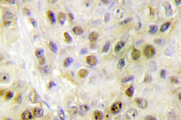 Polyclonal Rabbit anti-Human RORA / ROR Alpha Antibody (Gly41, IHC, IF, WB)