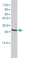 Monoclonal Mouse anti-Human CLTB Antibody (clone 4B12-1E3, IHC, IF, WB)