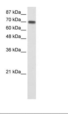 CARS1 / CARS Antibody (aa31-80, HRP)