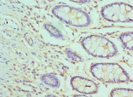 AP50 / AP2M1 Antibody (aa136-435)