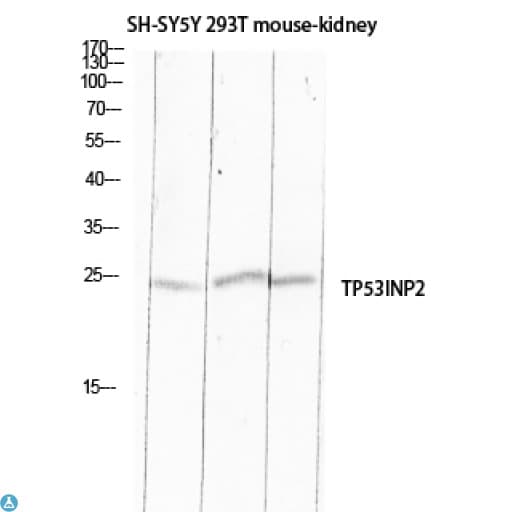 Polyclonal Rabbit anti-Human TP53INP2 Antibody (IHC, WB)