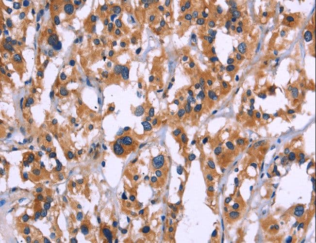 ZEB2 / SIP-1 Antibody