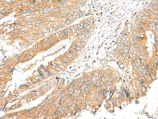 GPR151 Antibody