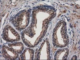 DSTN / Destrin Antibody (clone OTI1D8)