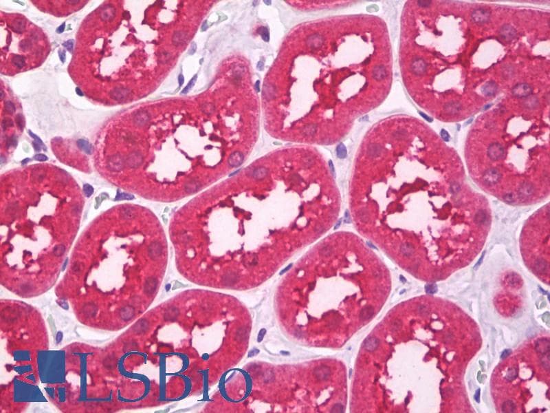 IHC-plus™ HTR3B / 5-HT3B Receptor Antibody (Internal)