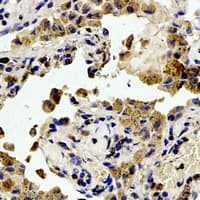 FAK / Focal Adhesion Kinase Antibody (phospho-Tyr407)