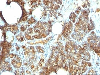 PTH / Parathyroid Hormone Antibody (C-Terminus, clone PTH/1173)