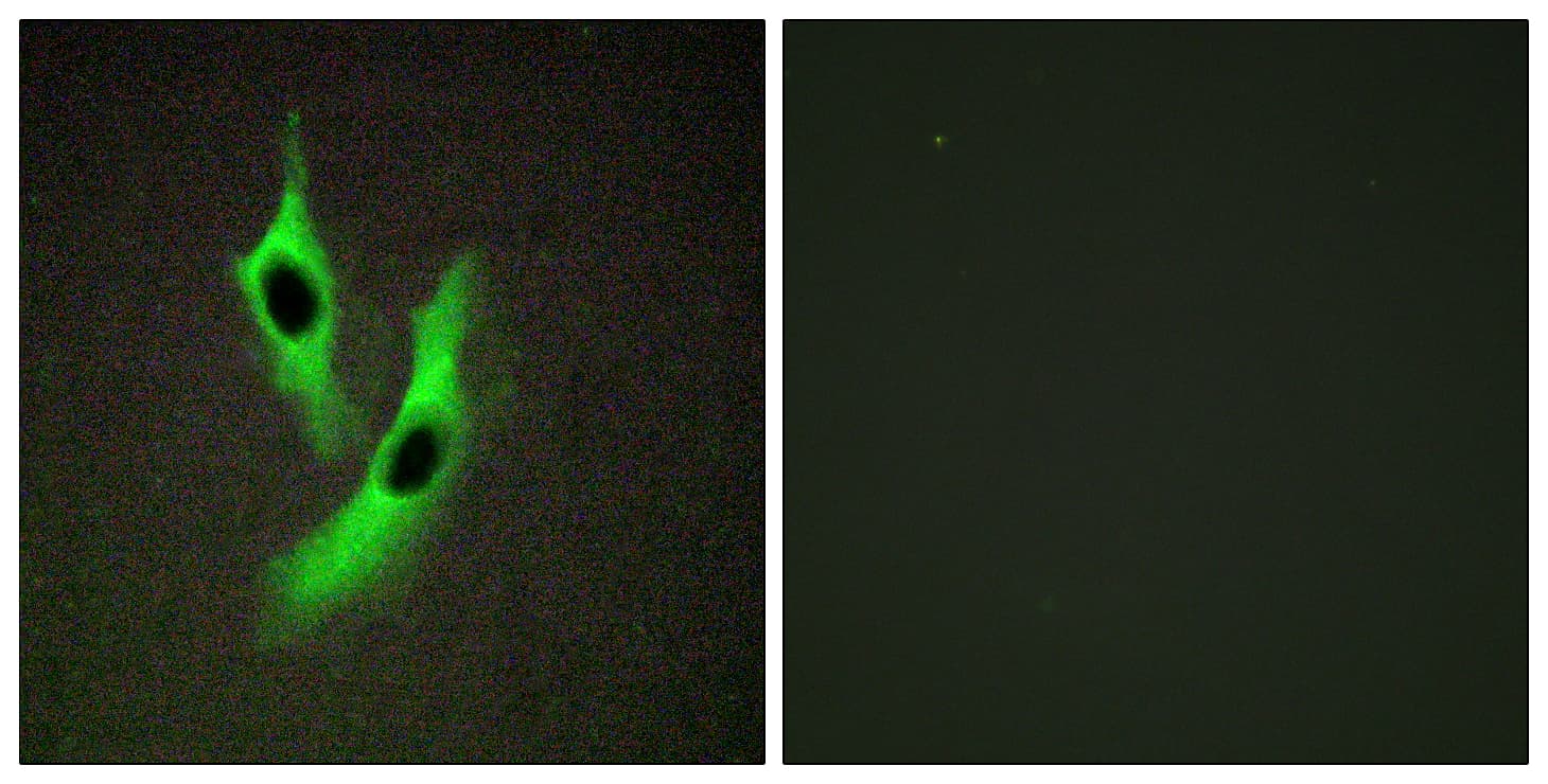 IHC-plus™ STEAP4 Antibody (aa201-250)