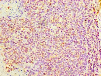 Polyclonal Rabbit anti-Human DNAH3 Antibody (aa1-150, IHC)