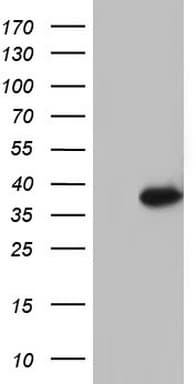 Monoclonal Mouse anti-Human GATAD1 Antibody (clone OTI1H1, aa68-269, WB)
