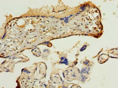 PDIA5 / PDIR Antibody