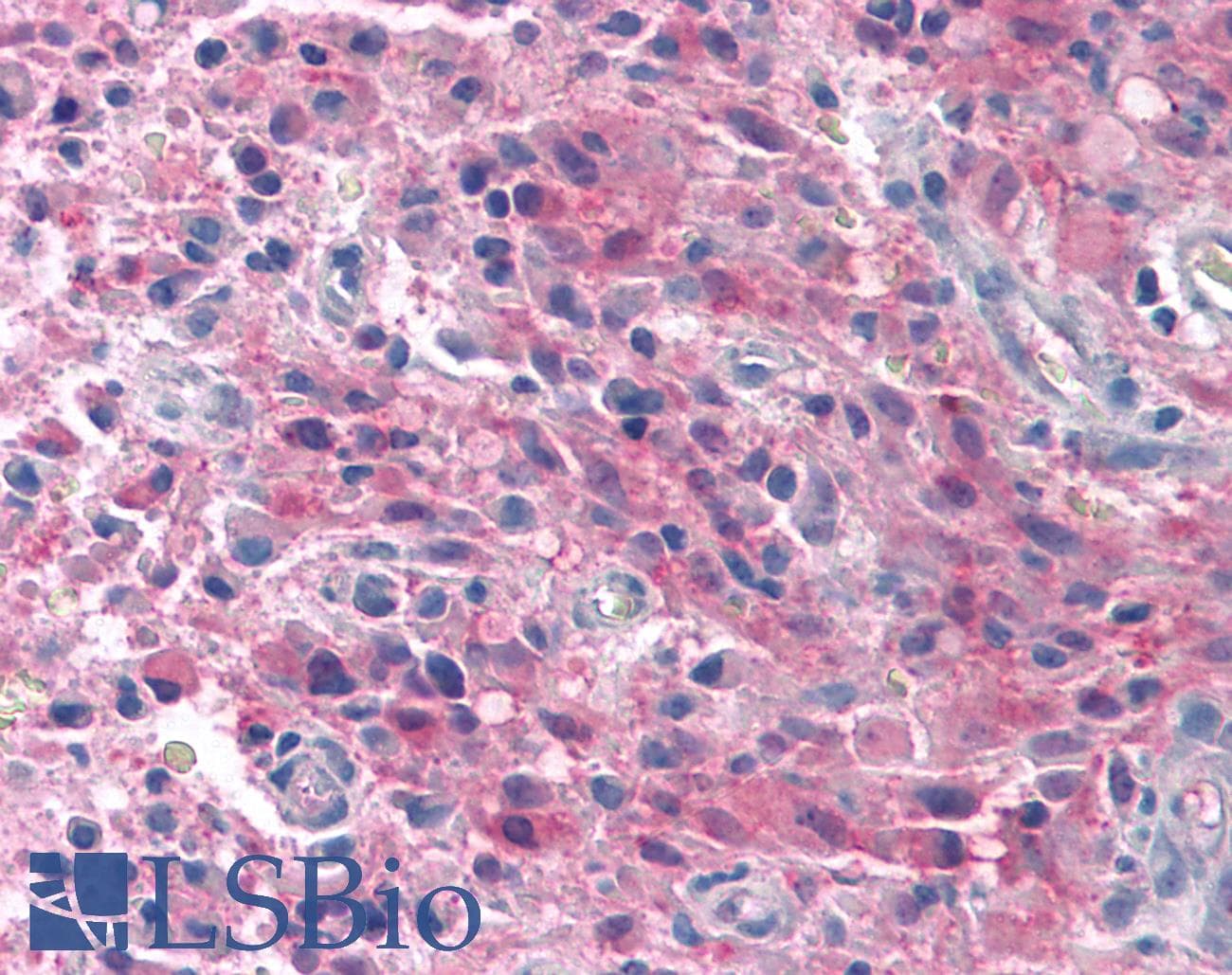 IHC-plus™ TRPM4 Antibody (C-Terminus)