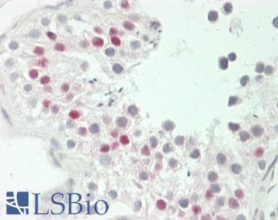 IHC-plus™ MYD118 / GADD45B Antibody (C-Terminus)