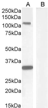 PathPlus™ c-Kit / CD117 Antibody (aa685-697)