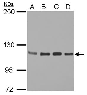 IHC-plus™ Polyclonal Rabbit anti-Human STAT2 Antibody (C-Terminus, IHC, WB)